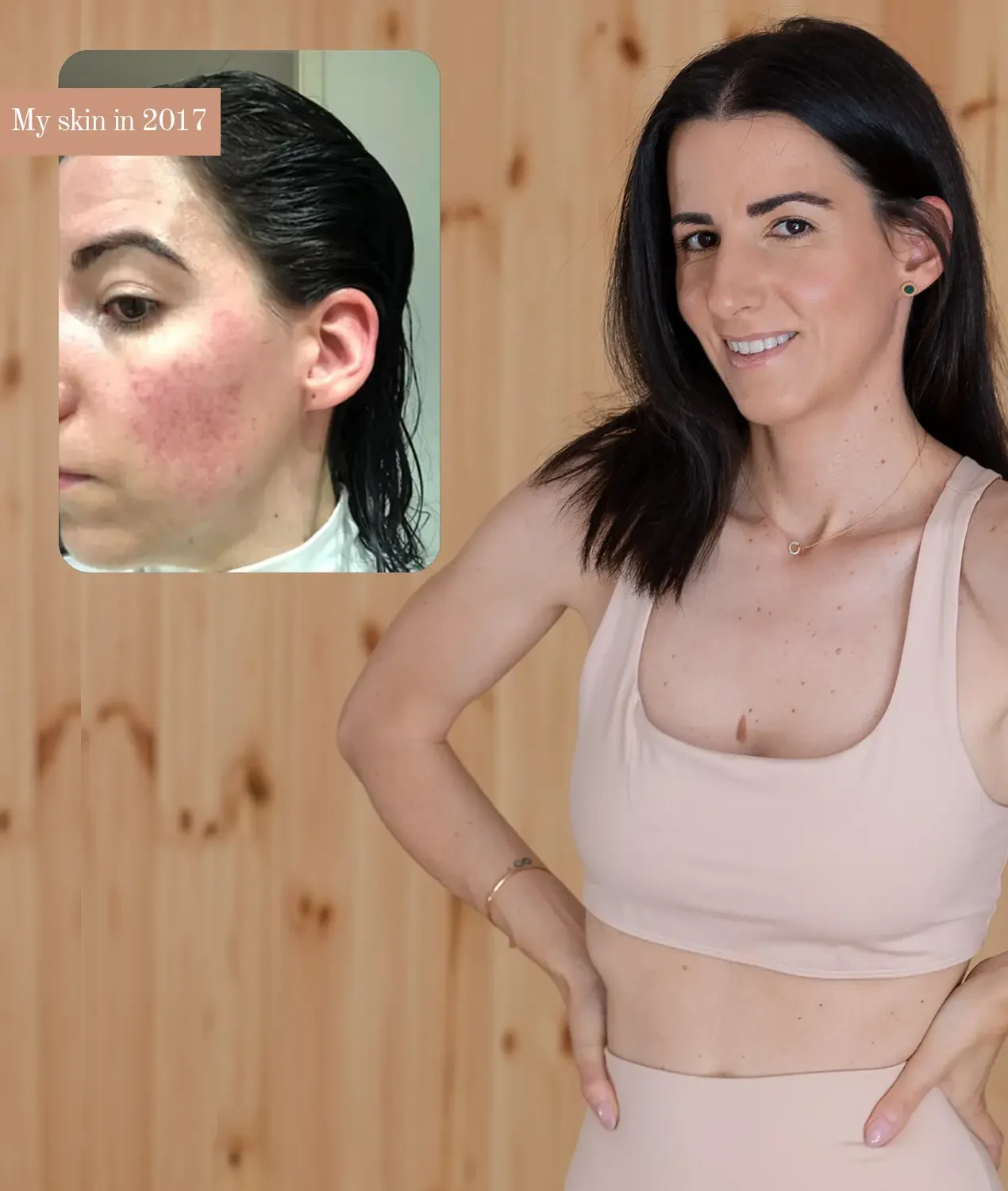 Skin before and after my anti-inflammatory reset